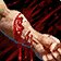 Crystal Lacerations